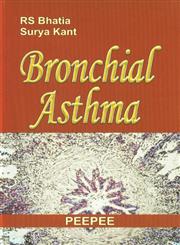 Bronchial Asthma 1st Edition,8184450176,9788184450170