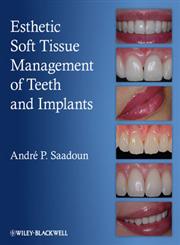 Esthetic Soft Tissue Management of Teeth and Implants,1118301153,9781118301159
