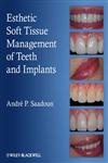 Esthetic Soft Tissue Management of Teeth and Implants,1118301153,9781118301159