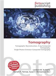 Tomography,6130335431,9786130335434