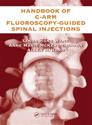 Handbook of C-Arm Fluoroscopy-Guided Spinal Injections 1st Edition,0849322545,9780849322549