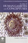 An Atlas of Human Gametes and Conceptuses An Illustrated Reference for Assisted Reproductive Technology 1st Edition,1850700168,9781850700166