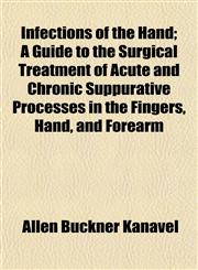 Infections of the Hand; A Guide to the Surgical Treatment of Acute and Chronic Suppurative Processes in the Fingers, Hand, and Forearm,115233591X,9781152335912