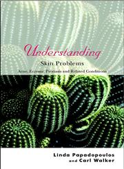 Understanding Skin Problems Acne, Eczema, Psoriasis and Related Conditions,047084518X,9780470845189