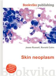 Skin Neoplasm,5511193682,9785511193687