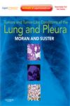 Tumors and Tumor-Like Conditions of the Lung and Pleura Expert Consult : Online and Print,1416036245,9781416036241