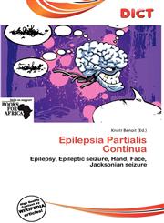 Epilepsia Partialis Continua,6200601399,9786200601391