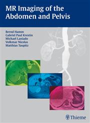 MR Imaging of the Abdomen and Pelvis 1st Edition,3131455918,9783131455918