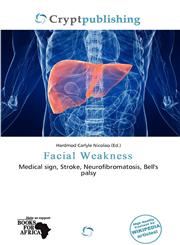 Facial Weakness,6200365024,9786200365026
